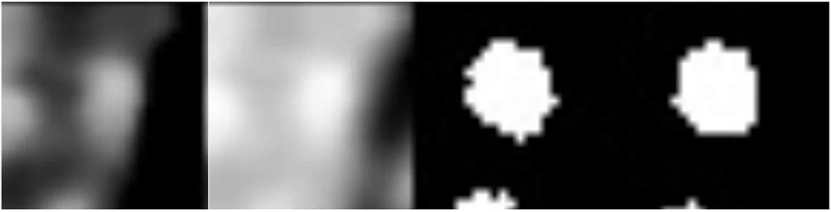 Two patches near-identical up to a window-level shift, whose masks disagree