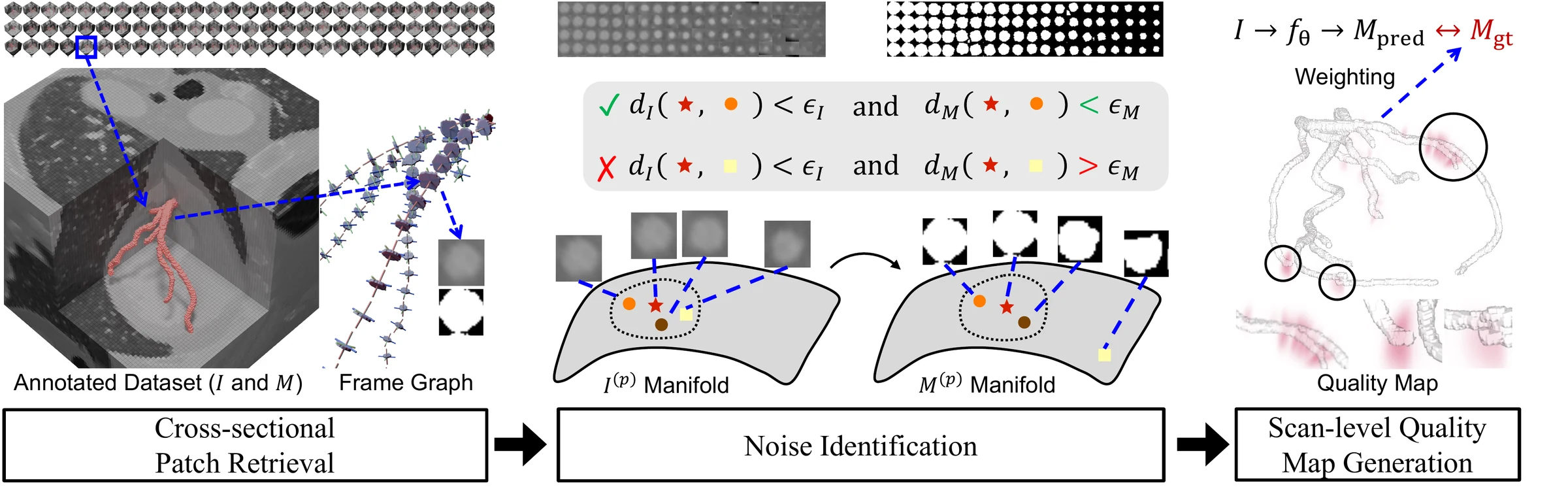 Pipeline: cross-sectional patches sampled along centreline frames, neighbours retrieved across subjects, scores aggregated into a scan-level quality map